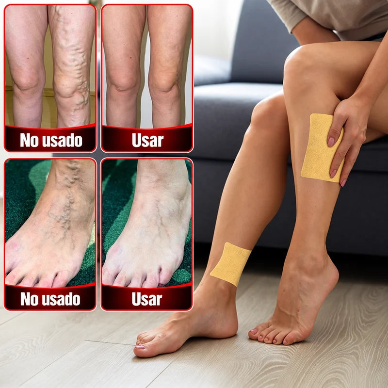 3x1 (36 parches) - PARCHES PARA VARICES Y PIERNAS CANSADAS